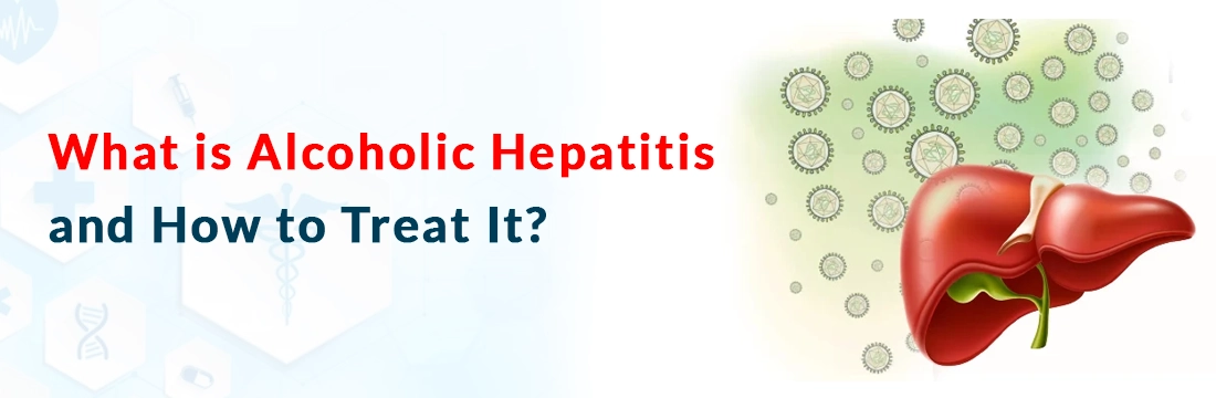 What is Alcoholic Hepatitis and How to Treat It?